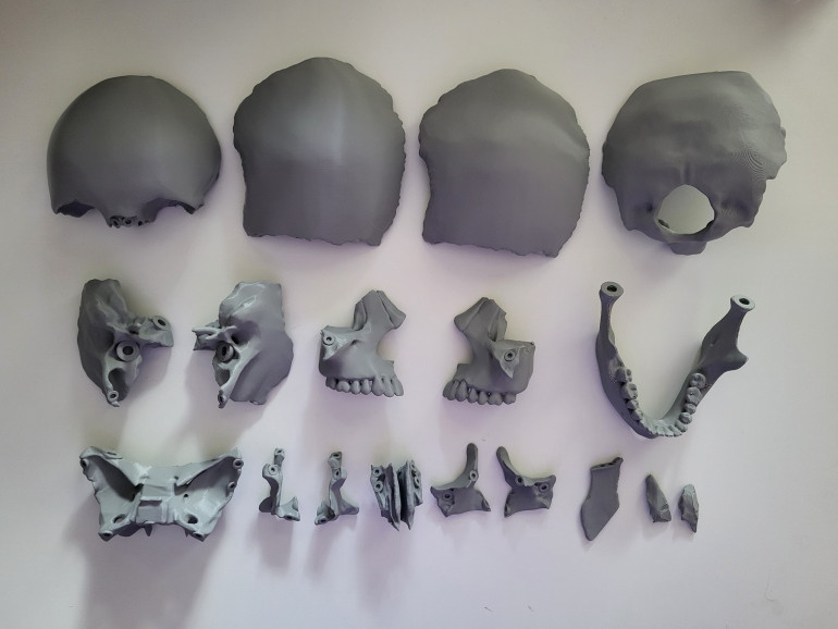 Uspješno realizovan projekt: Razvoj i proizvodnja 3D printanih modela kostiju glave i kičme u obrazovne i komercijalne svrhe